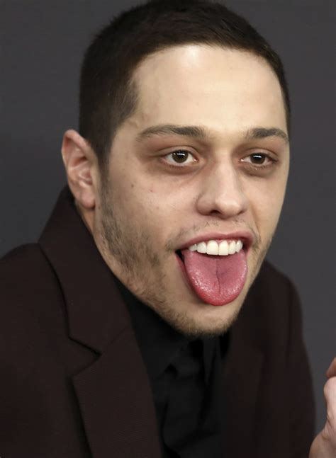 pete davidson dark circles under eyes.